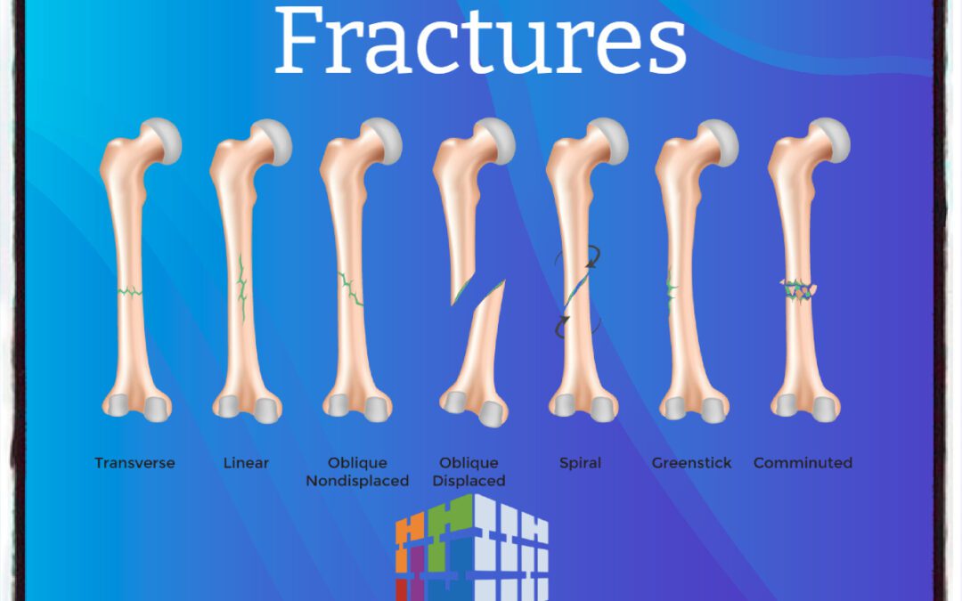 Medical Coding Fractures