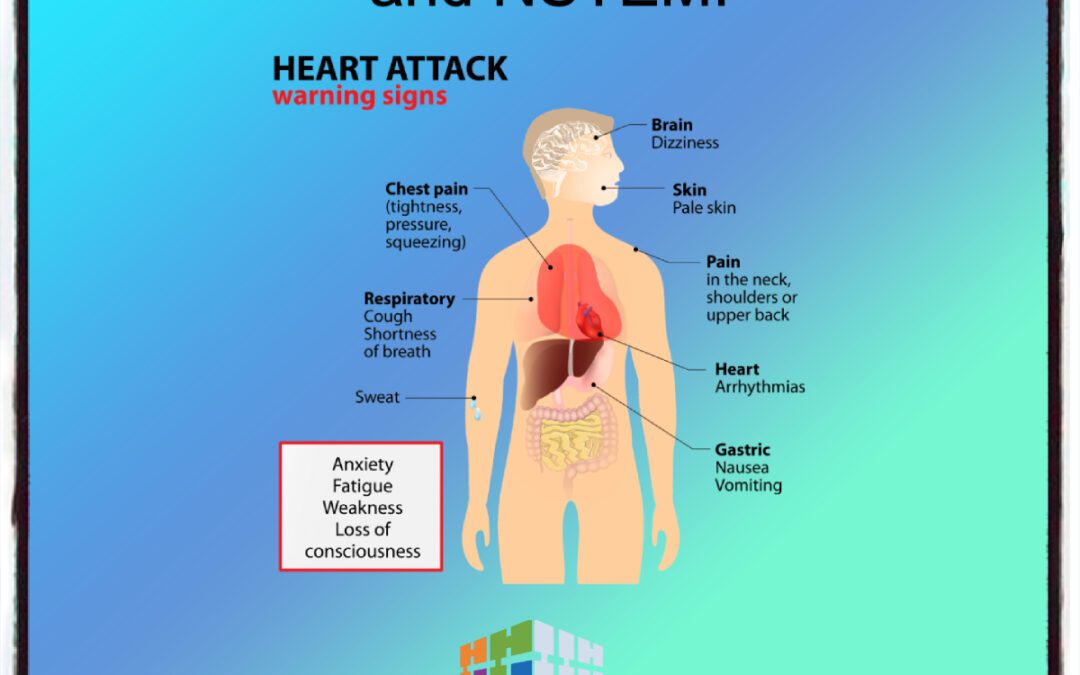 Medical Coding Cardio STEMI and NSTEMI