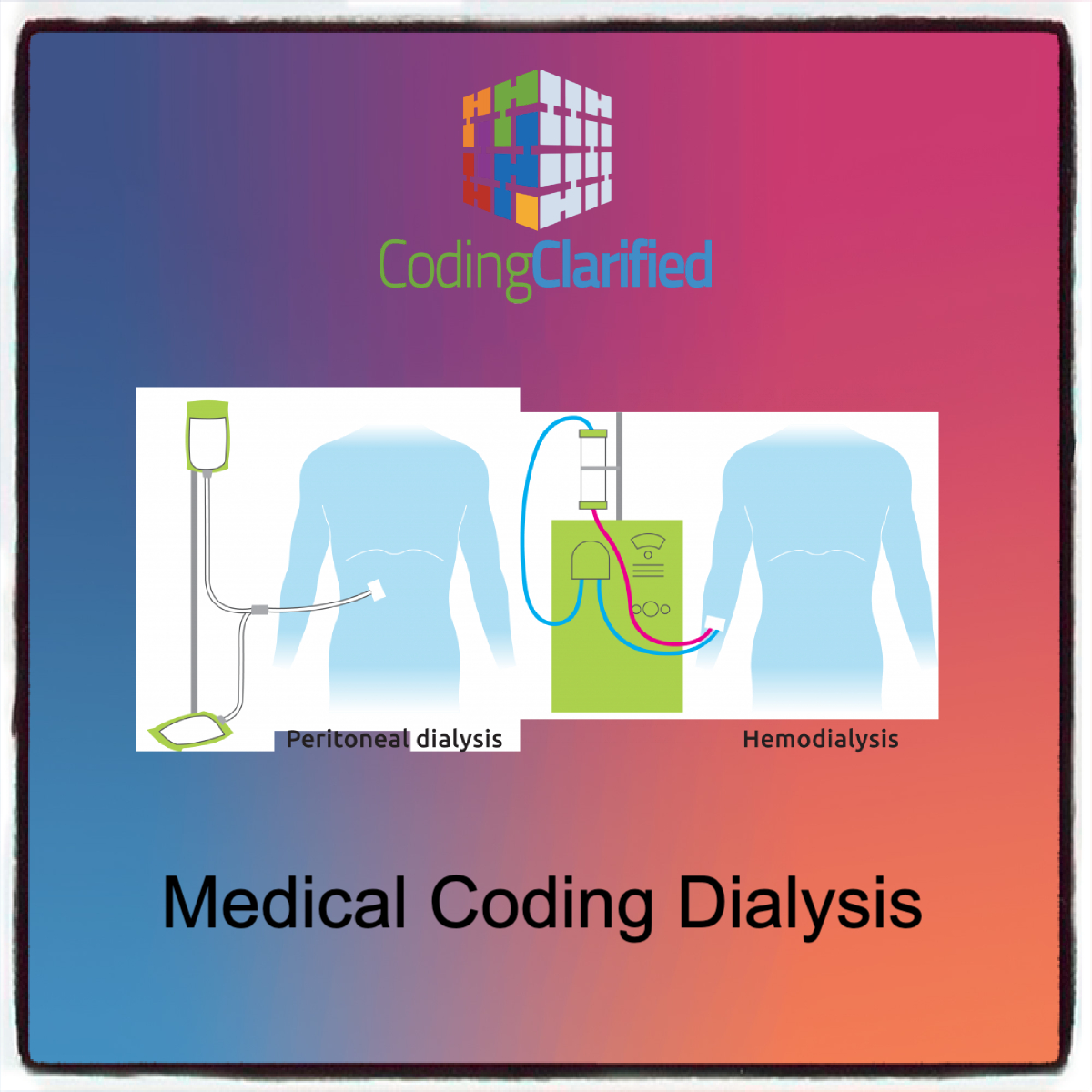 Medical Coding Dialysis graphic showing two different ways of getting dialysis: through an arm or through the torso.