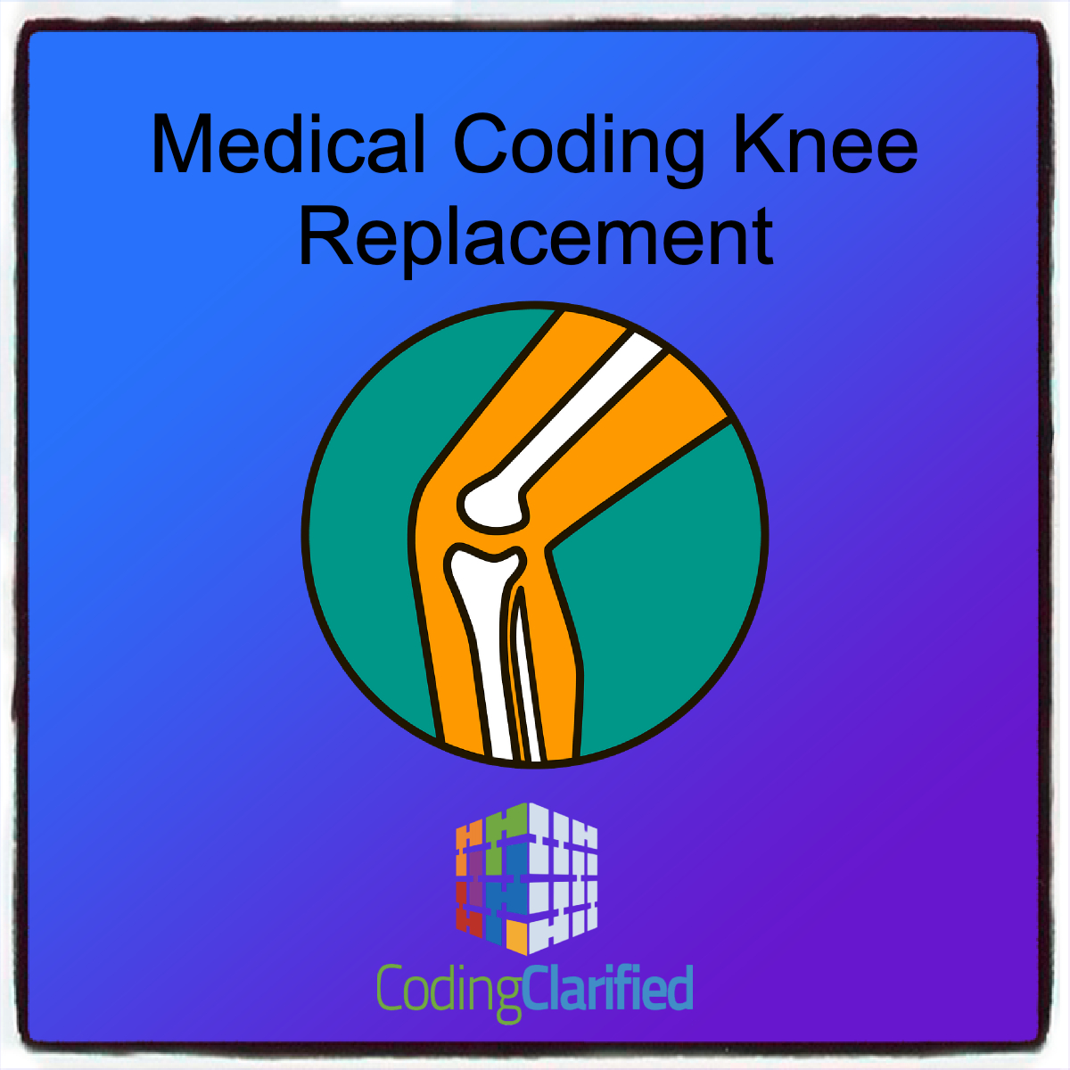 A graphic with a Medical Coding Knee Replacement title and a graphic of an x-ray of the knee followed by the Coding Clarified logo.