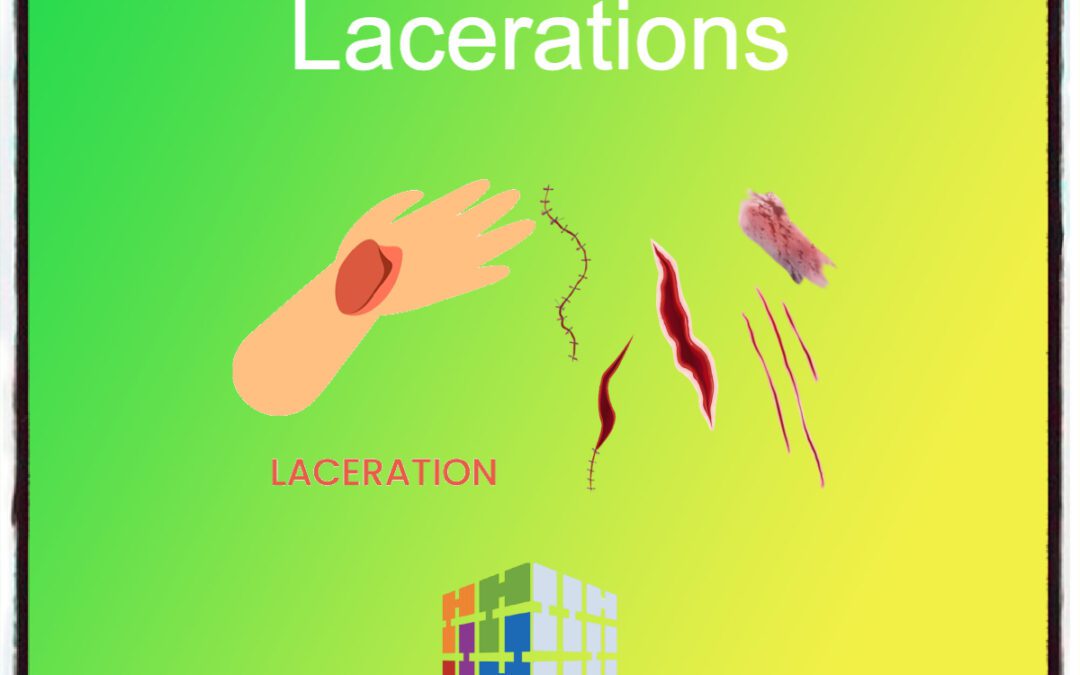 Medical Coding Lacerations