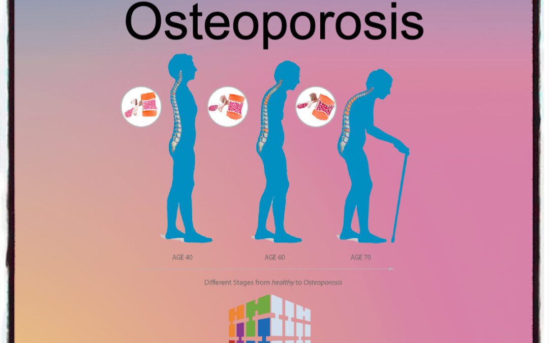 Medical Coding Osteoporosis