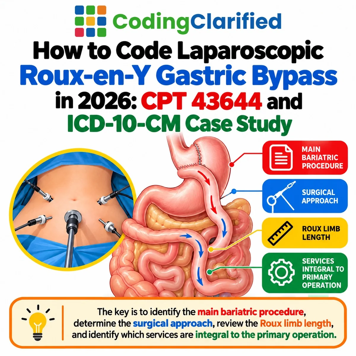 How to Code Laparoscopic Roux-en-Y Gastric Bypass in 2026: CPT 43644 and ICD-10-CM Case Study | Coding Clarified