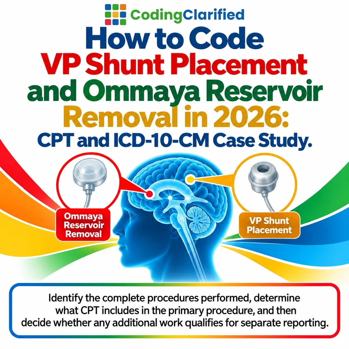 How to Code VP Shunt Placement and Ommaya Reservoir Removal in 2026: CPT and ICD-10-CM Case Study | Coding Clarified